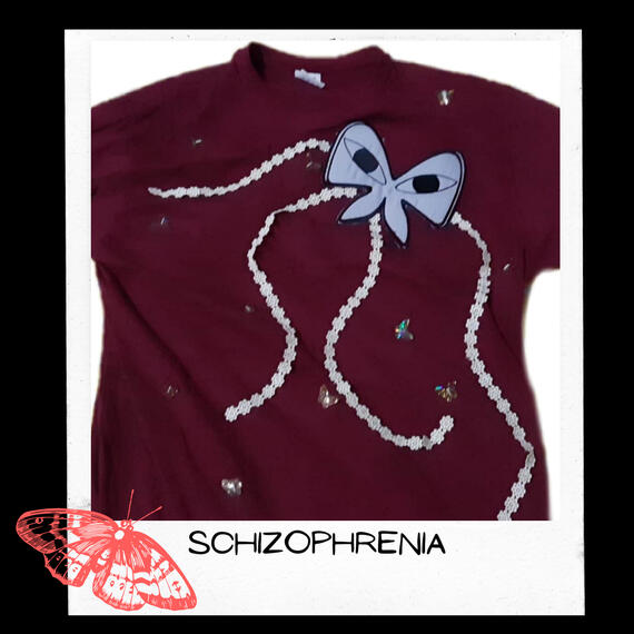 Schizophrenia